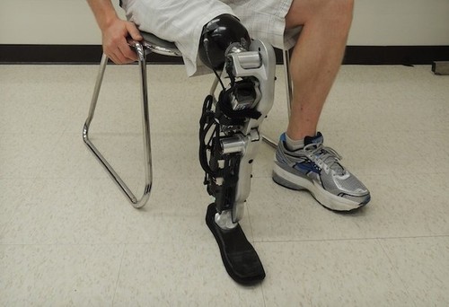 <em>人工</em>智能 全球首个成功的意念<em>控制</em>义肢_智能服