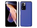 BSN note9/note9Pro/note10/n